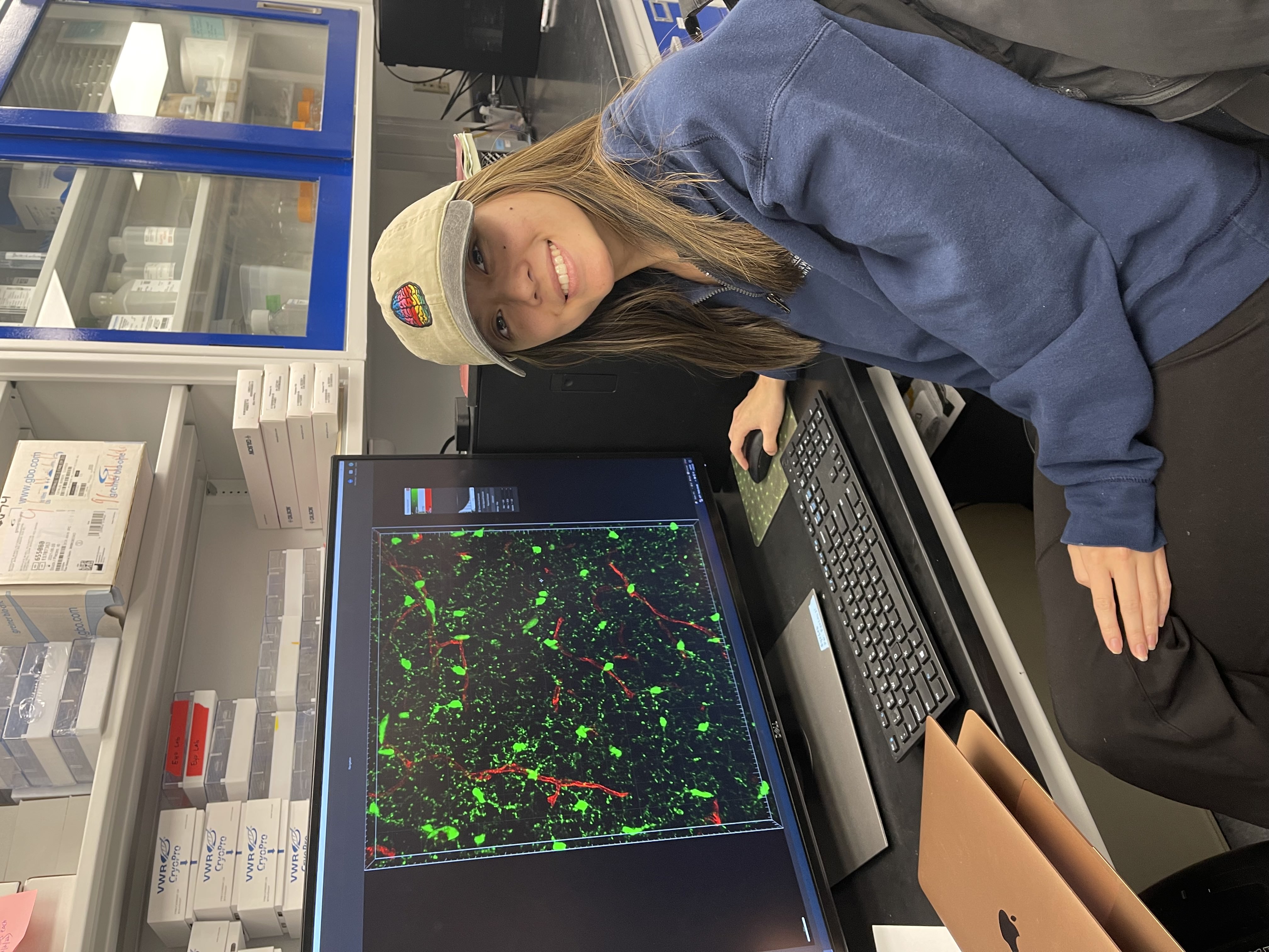 Vivian Cao-Dao reviews her research at the Eyo Neuroscience Lab at UVA